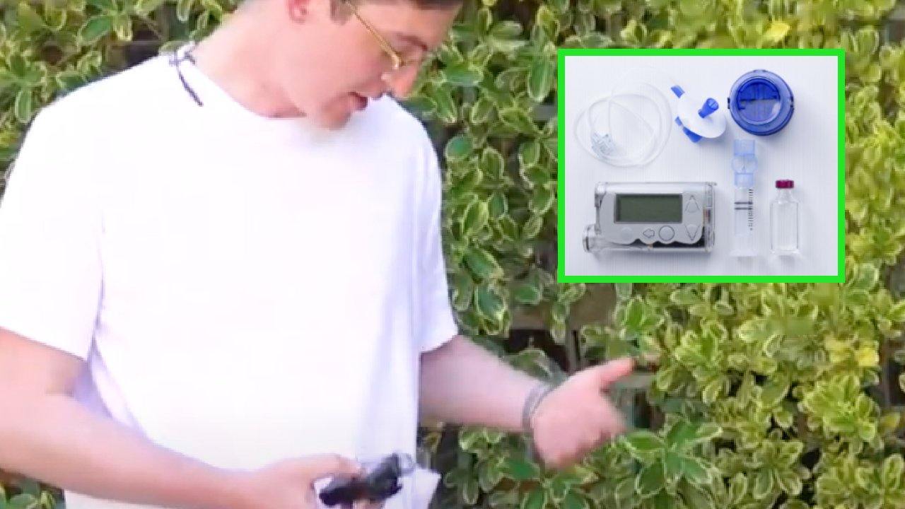 2 Common Insulin Pump Problems that Type 1 Diabetics Deal with all the time - Stitches Medical