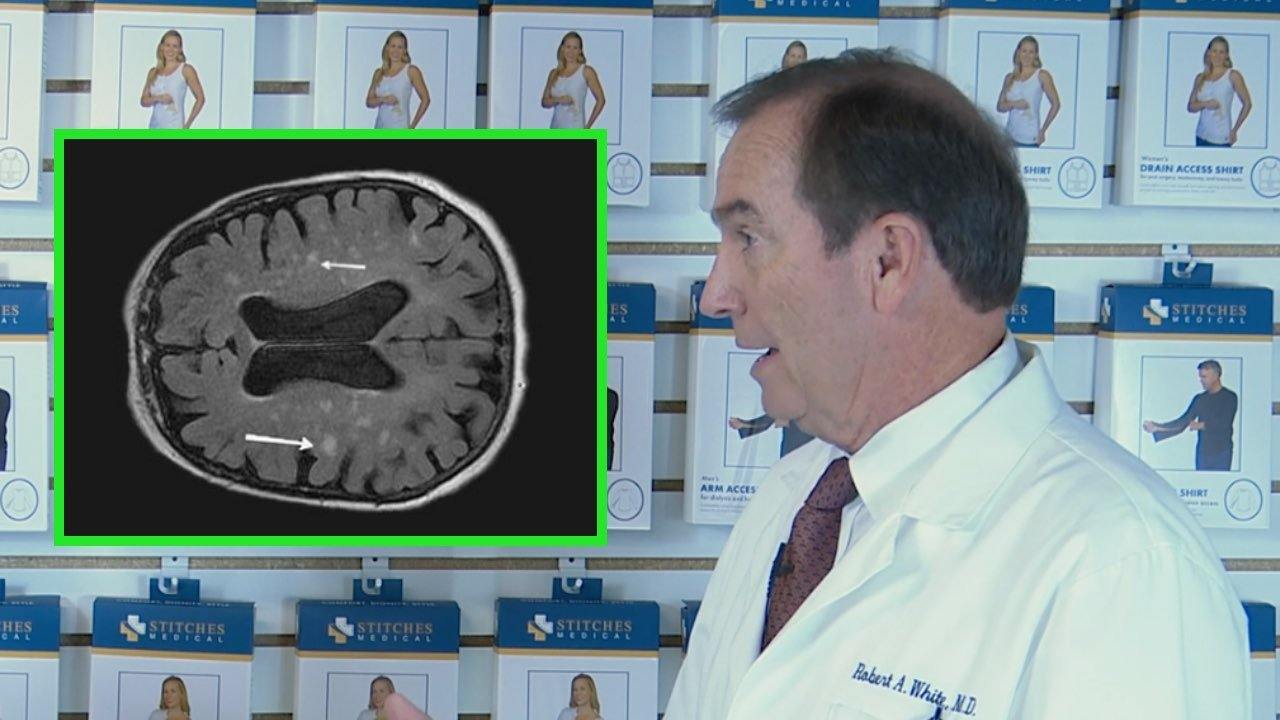 Alzheimer's vs Dementia - What are the Types & Causes? - Stitches Medical